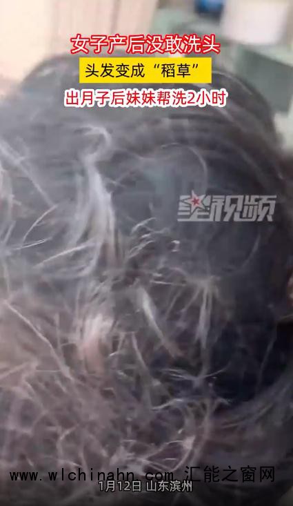 女子产后不洗头 头发变成&ldquo;稻草&rdquo;