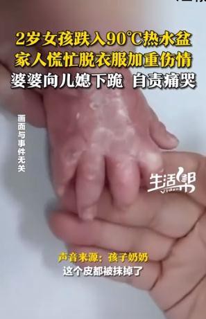 2岁娃烧伤 婆婆给儿媳下跪自责痛哭