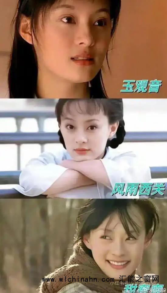 孙俪的唇下痣没了