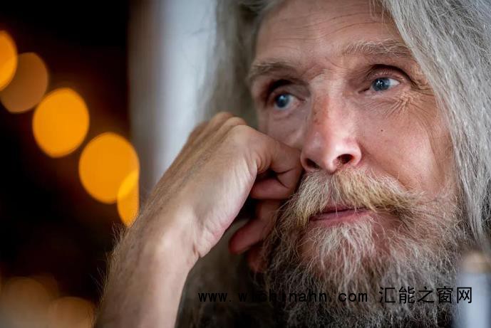 70岁世界第一美少年病逝