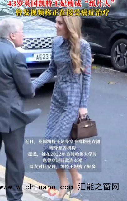 43岁英国凯特王妃瘦成纸片人
