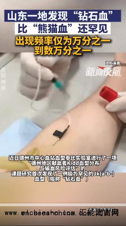 山东发现1例钻石血 比熊猫血更罕见