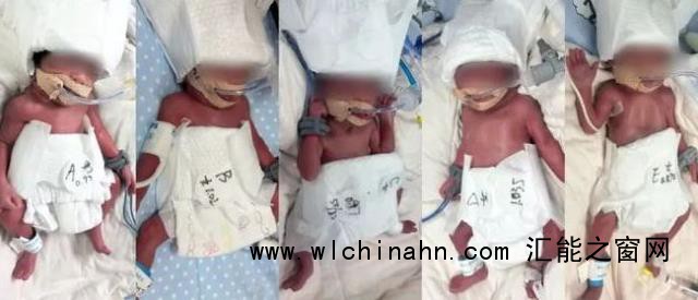 24岁女子成功诞下5胞胎