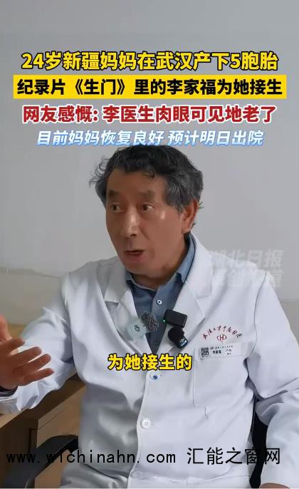 为5胞胎接生的专家肉眼可见地老了